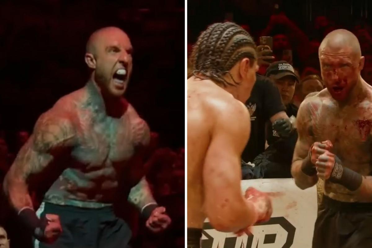 Alex Terrible Posts Bloody Aftermath of Latest Bare Knuckle Fight